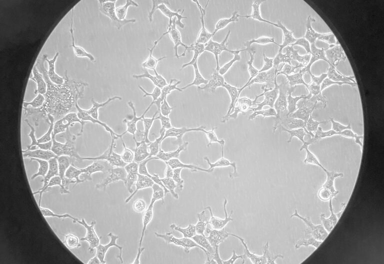 HEK-293 cells cultured in a DMEM medium.