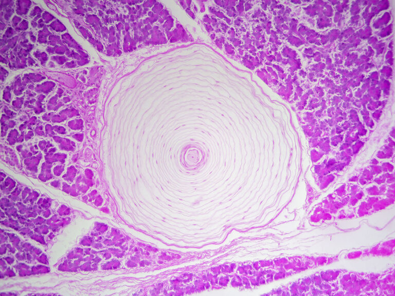 Histology microscope image of Pacinian corpuscle of the dermis i